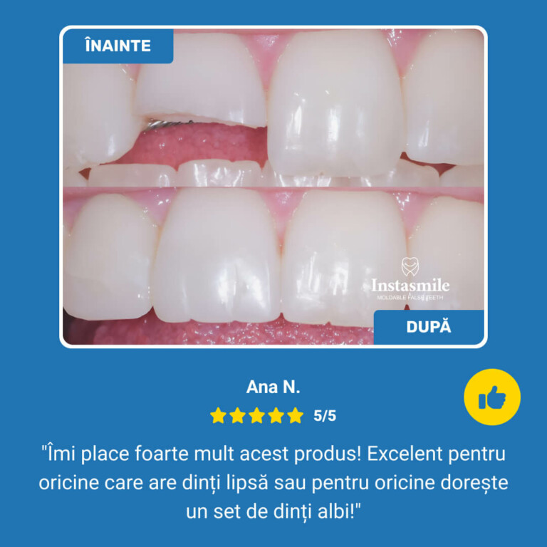 INSTASMILE KIT DE REPARARE A DINȚILOR - imagine 7